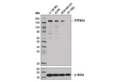 Cell Signaling Technology&nbsp;PTPN14 D5T6Y Rabbit mAb 100