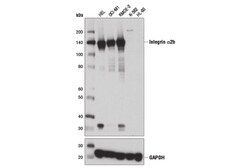 Cell Signaling Technology&nbsp;Integrin alpha-2b D8V7H Rabb