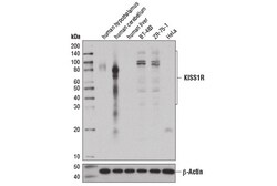 Cell Signaling Technology&nbsp;KISS1R D9D7C Rabbit mAb 100