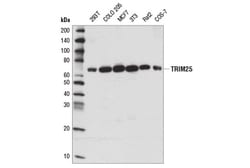 Cell Signaling Technology&nbsp;TRIM25 D9T7G Rabbit mAb 100