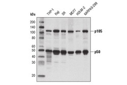 Cell Signaling Technology&nbsp;NF-kappa-B1 p105/p50 5D10D11