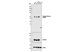 Cell Signaling Technology&nbsp;Phospho-Vimentin Ser39 Antib