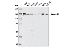 Cell Signaling Technology&nbsp;Myosin VI D5Y5A Rabbit mAb 1