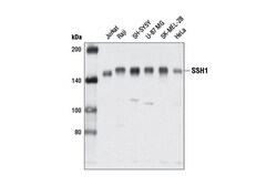 Cell Signaling Technology&nbsp;SSH1 E1K3W Rabbit mAb 100 ul