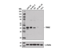Cell Signaling Technology&nbsp;TRIB2 D8P2X Rabbit mAb 100 u