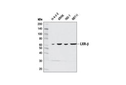 Cell Signaling Technology&nbsp;LXR-beta D6M9D Rabbit mAb 10