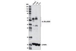 Cell Signaling Technology&nbsp;IL-2R-alpha/CD25 D6K5F Rabbi