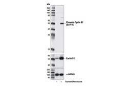 Cell Signaling Technology&nbsp;Phospho-Cyclin B1 Ser116 Ant