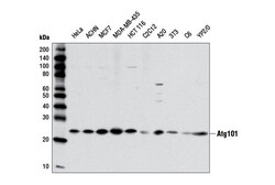Cell Signaling Technology&nbsp;Atg101 E1Z4W Rabbit mAb 100