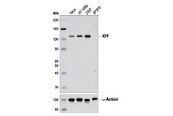 Cell Signaling Technology&nbsp;XPF D3G8C Rabbit mAb 100 ul