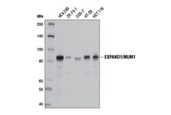 Cell Signaling Technology&nbsp;EXPAND1/MUM1 D1Z6Y Rabbit mA