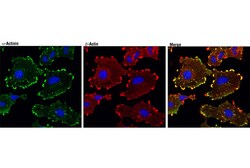 Cell Signaling Technology&nbsp;Focal Adhesion Protein Antibod