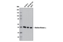 Cell Signaling Technology&nbsp;Choline Kinase alpha D5X9W R