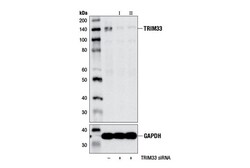Cell Signaling Technology&nbsp;TRIM33 E1N2Z Rabbit mAb 100