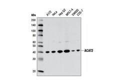 Cell Signaling Technology&nbsp;ACAT2 E1L8V Rabbit mAb 100 u