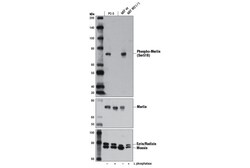 Cell Signaling Technology&nbsp;Phospho-Merlin Ser518 D5A4I
