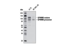 Cell Signaling Technology&nbsp;GPNMB E1Y7J Rabbit mAb 100 u