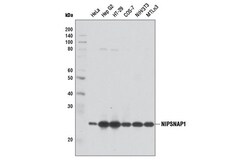 Cell Signaling Technology&nbsp;NIPSNAP1 D1Y6S Rabbit mAb 10