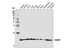 Cell Signaling Technology&nbsp;CRABP1 D5W9A Rabbit mAb 100