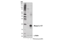 Cell Signaling Technology&nbsp;IL-17F D3M4D Rabbit mAb 100