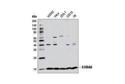 Cell Signaling Technology&nbsp;S100A6 D3H3W Rabbit mAb 100