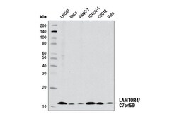 Cell Signaling Technology&nbsp;LAMTOR4/C7orf59 D4P6O Rabbit