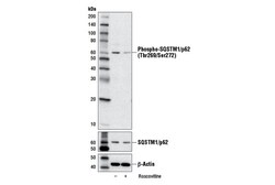 Cell Signaling Technology&nbsp;Phospho-SQSTM1/p62 Thr269/Ser