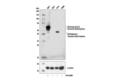 Cell Signaling Technology Tyrosine Hydroxylase A8Y7R R