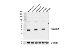 Cell Signaling Technology&nbsp;Troponin I D6F8 Rabbit mAb 1