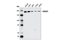 Cell Signaling Technology&nbsp;IQGAP2 D1X8U Rabbit mAb 100