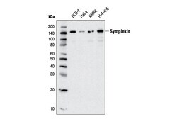 Cell Signaling Technology&nbsp;Symplekin D5Y3T Rabbit mAb 1