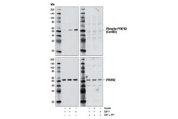 Cell Signaling Technology&nbsp;Phospho-PFKFB2 Ser483 D4R1W