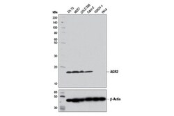 Cell Signaling Technology&nbsp;AGR2 D9V2F XPR Rabbit mAb