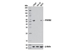 Cell Signaling Technology&nbsp;PFKFB2 D7G5R Rabbit mAb 100