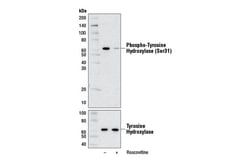 Cell Signaling Technology Phospho-Tyrosine Hydroxylase