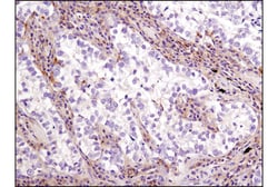 Cell Signaling Technology&nbsp;LKB1 D60C5F10 Rabbit mAb IH