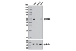 Cell Signaling Technology&nbsp;PFKFB2 D5I5F Rabbit mAb 100