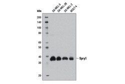 Cell Signaling Technology&nbsp;Spry1 D9V6P Rabbit mAb 100 u