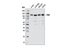 Cell Signaling Technology&nbsp;FAK D2R2E Rabbit mAb 100 ul