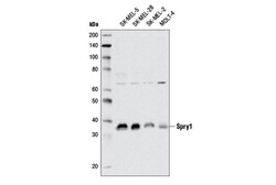 Cell Signaling Technology&nbsp;Spry1 D9V6I Rabbit mAb 100 u