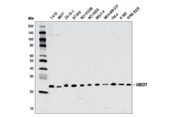 Cell Signaling Technology&nbsp;UBE2T D2L7H Rabbit mAb 100 u