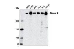 Cell Signaling Technology&nbsp;Filamin B D7E4W Rabbit mAb 1