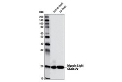 Cell Signaling Technology&nbsp;Myosin Light Chain 2v D5I1C