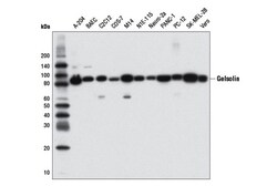 Cell Signaling Technology&nbsp;Gelsolin D9W8Y Rabbit mAb 10