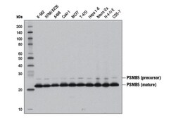 Cell Signaling Technology&nbsp;PSMB5 D1H6B Rabbit mAb 100 u