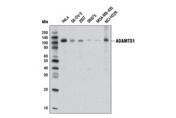 Cell Signaling Technology&nbsp;ADAMTS1 D5G4Z Rabbit mAb 100