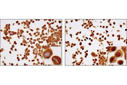 Cell Signaling Technology&nbsp;SignalSlideRNF-kappa-B p65