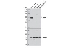 Cell Signaling Technology&nbsp;Prostatic Acid Phosphatase D3