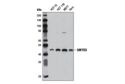 Cell Signaling Technology&nbsp;SMYD3 D2Q4V Rabbit mAb 100 u
