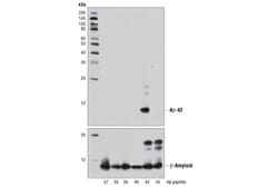 Cell Signaling Technology&nbsp;beta-Amyloid 1-42 D3E10 Ra